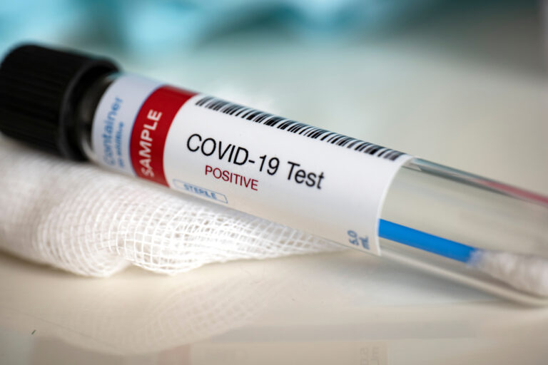 Free COVID Tests, Hotline Will End Friday, Health Department Announces
